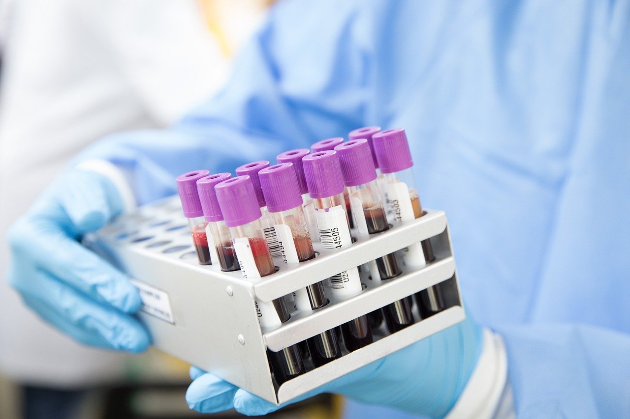 Rack of blood sample tubes used to run a dog blood chemistry panel